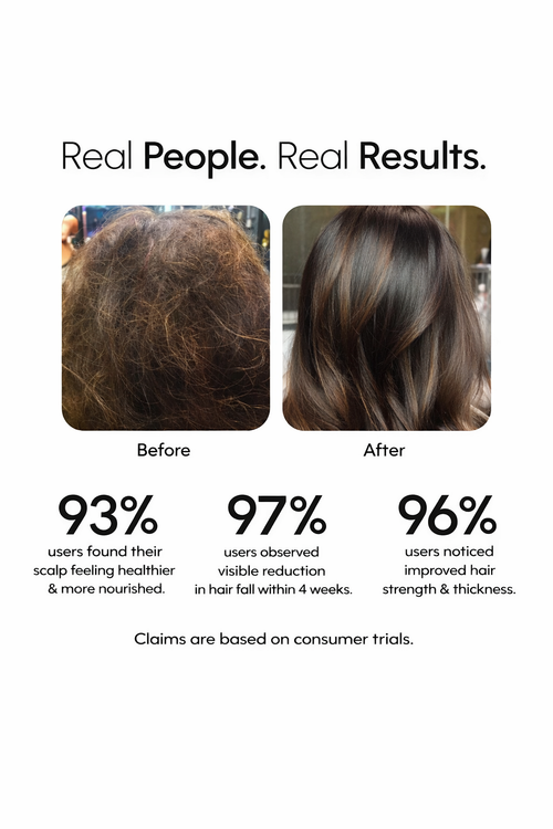 Rosemary Hair Growth Spray